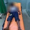 Bocah di Baubau Kena Sabetan Pisau saat Lindungi Ibu yang Dianiaya Ayah