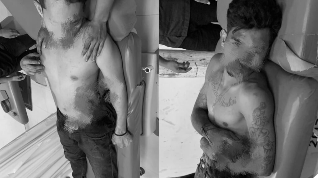 Dua korban pembusuran di Kendari.