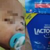Bayi 7 Bulan di Kendari Jadi Korban Susu Kedaluwarsa, Sekujur Badan Berbintik Merah