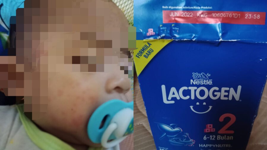 Bayi 7 Bulan di Kendari Jadi Korban Susu Kedaluwarsa, Sekujur Badan Berbintik Merah Bayi 7 Bulan di Kendari Jadi Korban Susu Kedaluwarsa, Sekujur Badan Berbintik Merah