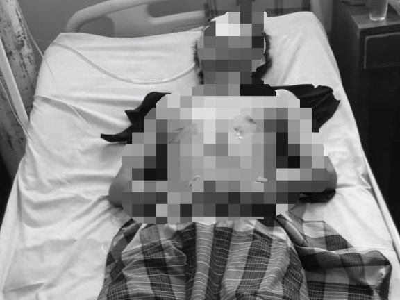 Korban penikaman dilarikan di RS Bhayangkara Kendari. 