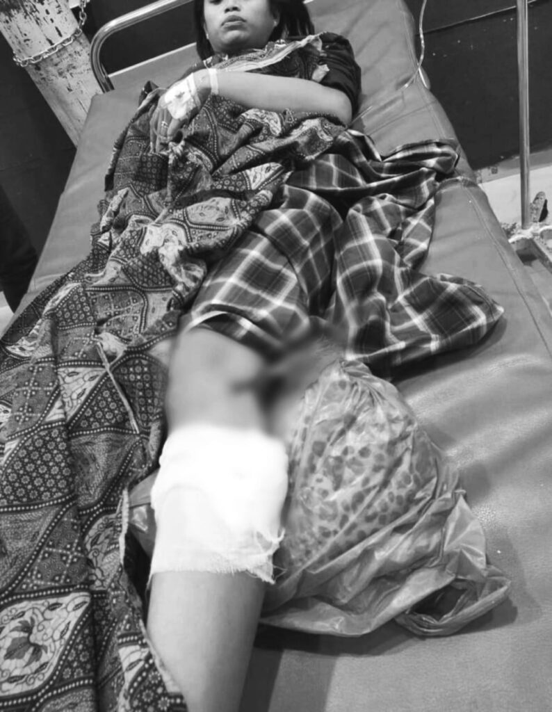 Ibu rumah tangga di Kota Kendari bernama Suriyanti mendapat perawatan medis usai menjadi korban pembusuran oleh OTK.