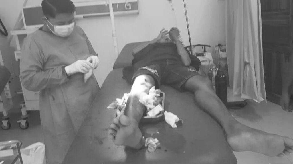 Musbar (27) menjalani operasi pencabutan mata busur di RSUD Kota Kendari.