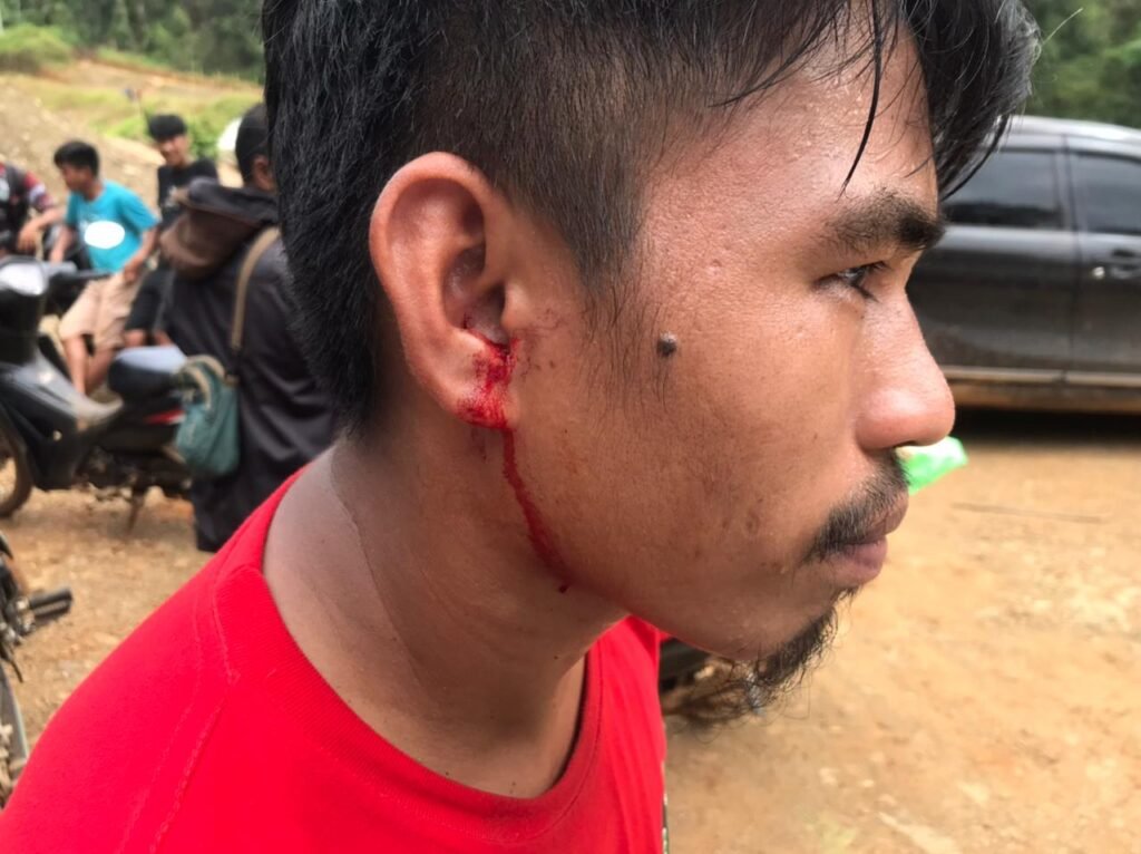 Warga Routa yang terluka akibat unjuk rasa PT SCM.