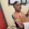 Smelter di PT OSS Morosi Meledak, Alat Berat Terbakar dan 1 Orang Luka Bakar Tersembur Lumpur