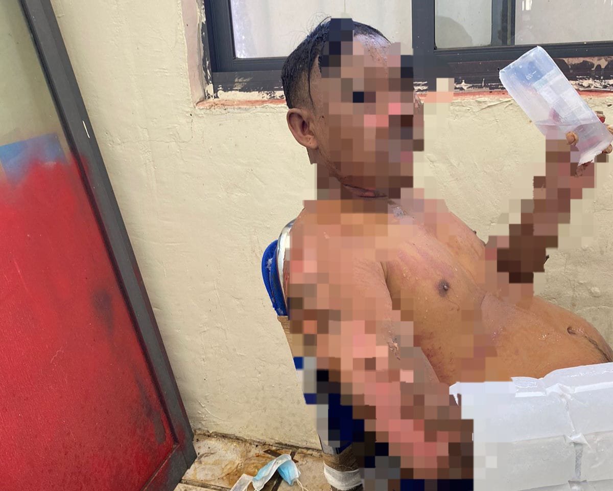 1 Orang Luka Bakar Akibat Smelter PT OSS Morosi yang Meledak pada April Lalu Meninggal Dunia 1 Orang Luka Bakar Akibat Smelter PT OSS Morosi yang Meledak pada April Lalu Meninggal Dunia