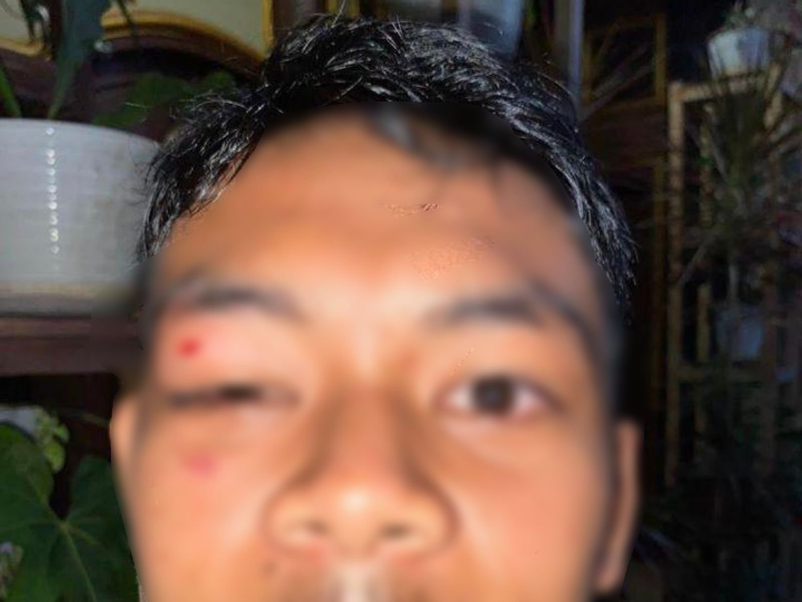 Pelajar SMA di Baubau Dianiaya Teman Sekolah hingga Wajah Memar Pelajar SMA di Baubau Dianiaya Teman Sekolah hingga Wajah Memar