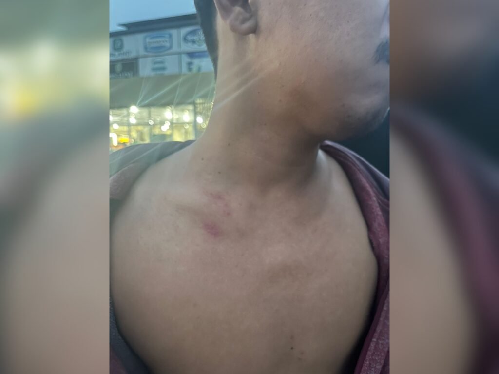 Mahasiswa berinisial W (24) mengalami luka-luka diduga dikeroyok oknum TNI berinisial AA yang bertugas di Kodim 1417/Kendari.