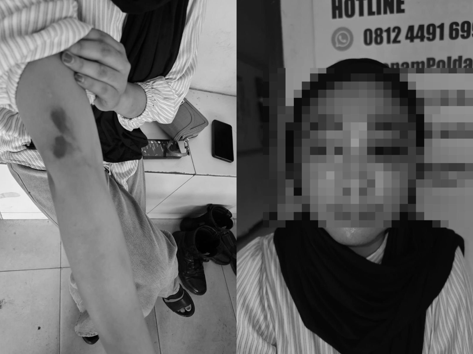 Oknum Polres Konut Aniaya Kekasih hingga Babak Belur di Kendari Oknum Polres Konut Aniaya Kekasih hingga Babak Belur di Kendari