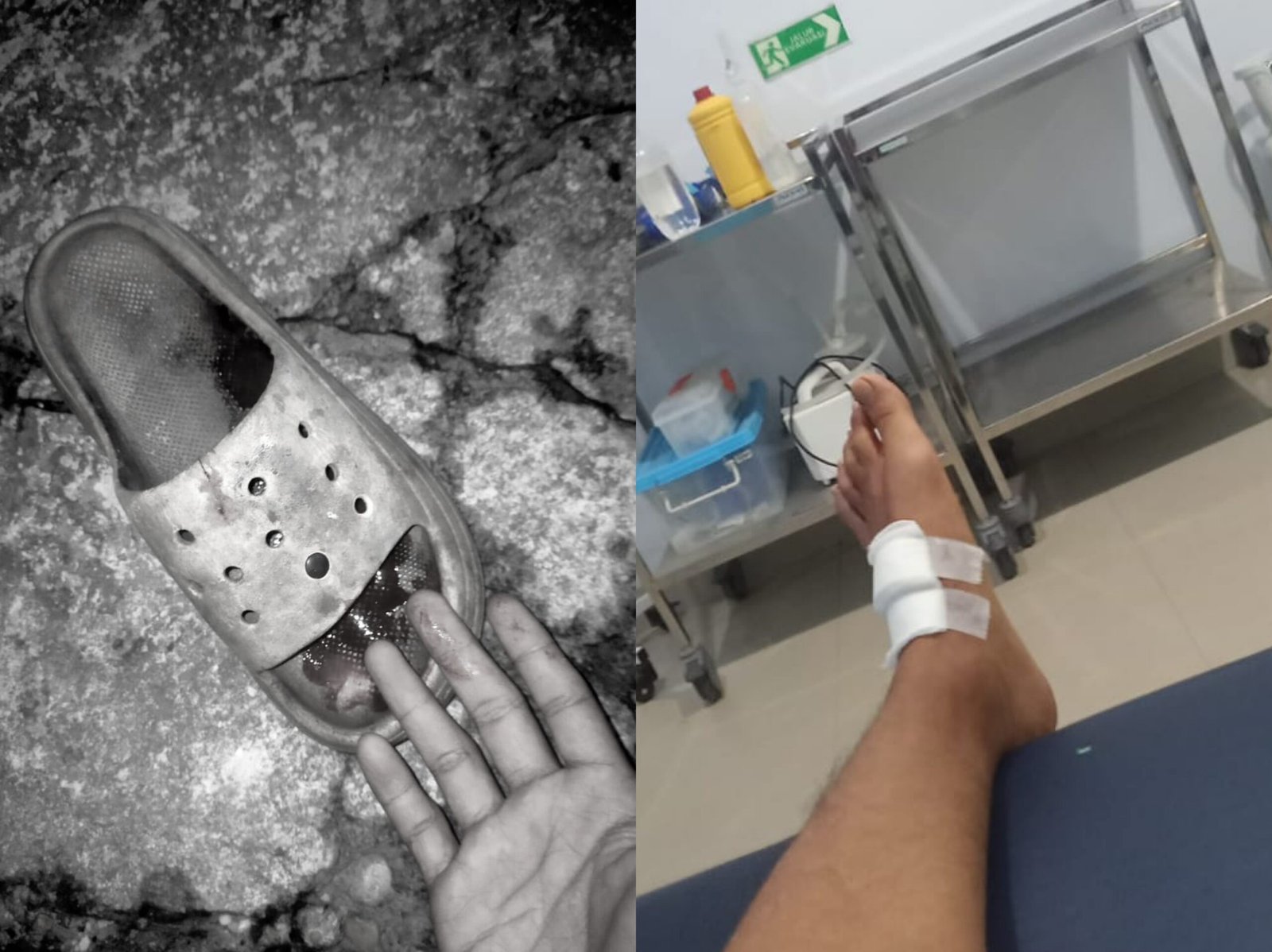 Pria Konsel Dilempar Pisau oleh OTK hingga Tertancap di Kaki Pria Konsel Dilempar Pisau oleh OTK hingga Tertancap di Kaki