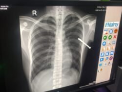 Niat Antar Teman, Warga Wamponiki Dibusur di Wapunto, Muna