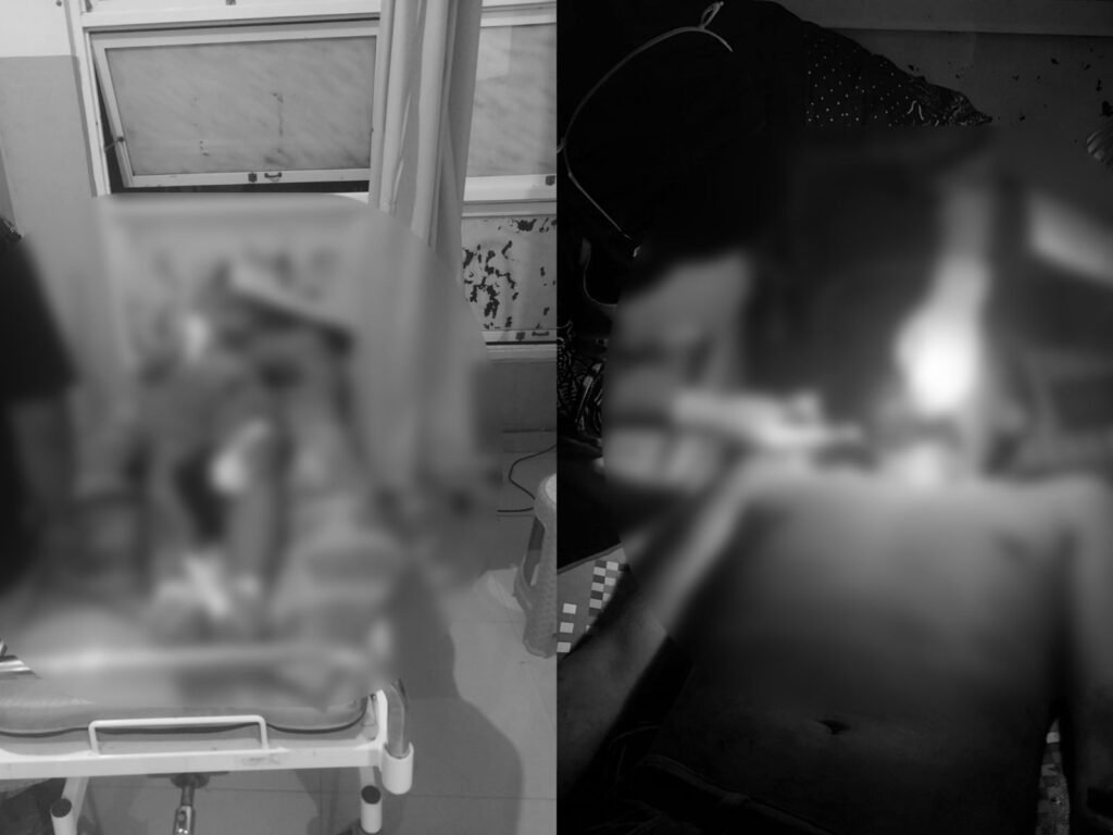 Korban penganiayaan di Teras Rumah Kepala Desa Wundumbolo, Kecamatan Tinanggea, Kabupaten Konawe Selatan berinisial H (36) saat dirawat di Puskesmas Tinanggea.