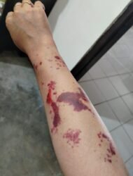 Kepala Seksi Dinas PUPR Muna Diduga Aniaya Mantan Istri, Penyelidikan di Polsek Katobu Mandek