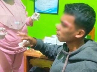 Ricuh 2 Kelompok Pemuda saat Acara Joget di Busel, 3 Remaja Alami Luka