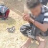 Remaja di Kendari Jadi Korban Tabrak Lari, Paha Patah Usai Ditabrak Hilux