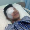 Dibacok OTK hingga Buta, Pria di Baubau Malah Dijadikan Tersangka Penganiayaan