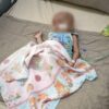 Sakit Kanker Kelenjar Getah Bening, Balita asal Mubar Siti Fatimah Az Zahra Butuh Uluran Tangan