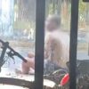 Pria di Muna Bakar Diri Dalam Rumah hingga Seluruh Tubuh Melepuh, Diduga Gangguan Jiwa