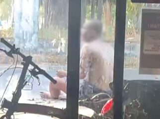 Pria di Muna Bakar Diri Dalam Rumah hingga Seluruh Tubuh Melepuh, Diduga Gangguan Jiwa