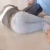 Pemotor 18 Tahun Patah Kaki Usai Tabrakan dengan Terios di Konawe
