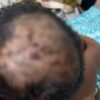 Kronologi Bocah SD di Konut Dicekik lalu Ditusuk Gunting Usai Diajak Main Free Fire